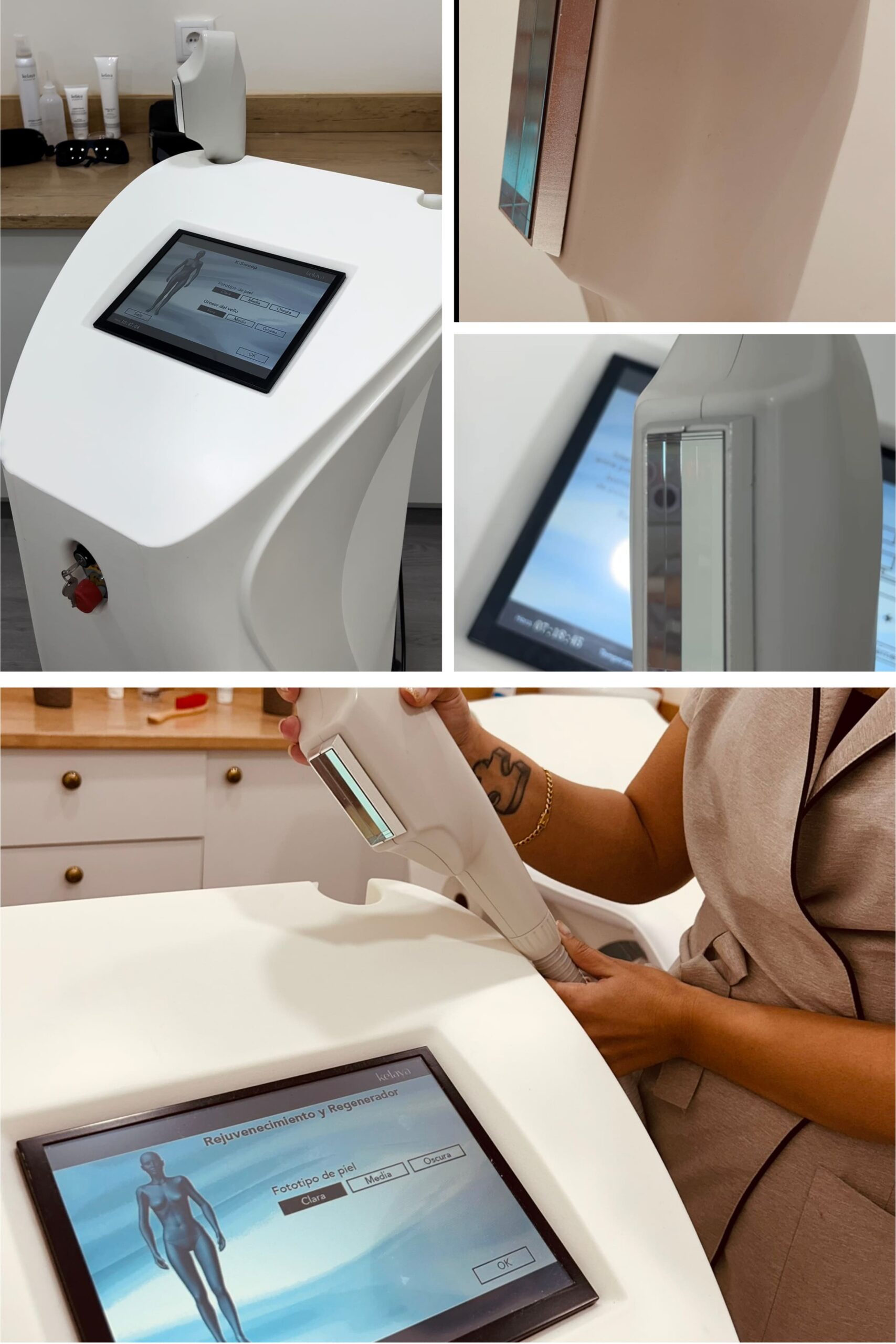 Servicio Laser IPL